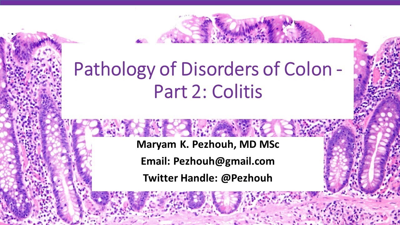 Part 2 of Pathology of Colonic disorders- Colitis