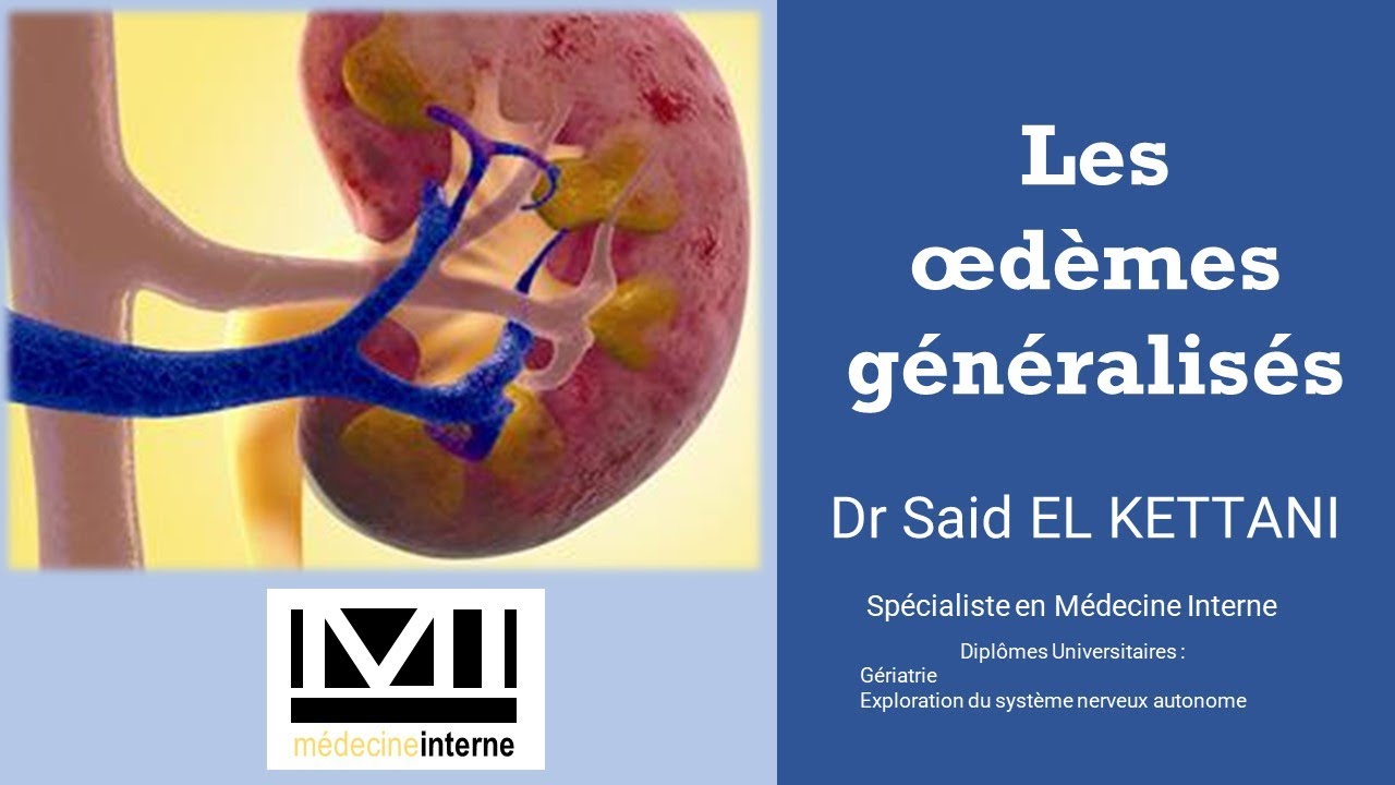 Les œdèmes généralisés : Ce que Vous Devez Absolument Savoir