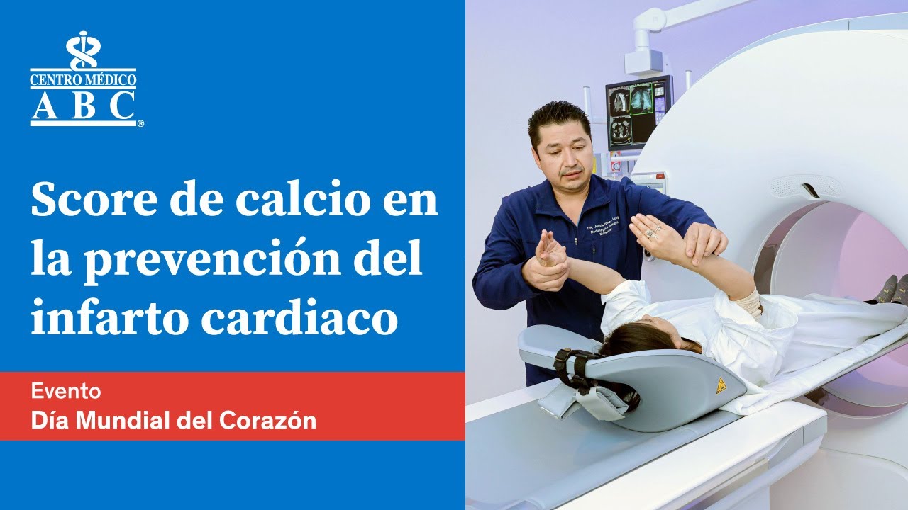 Webinar: Prevenir el infarto con el Score de Calcio