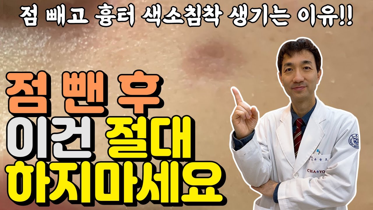 점빼고 흉터 색소침착 남지 않는✔️ 점제거 후관리 방법!