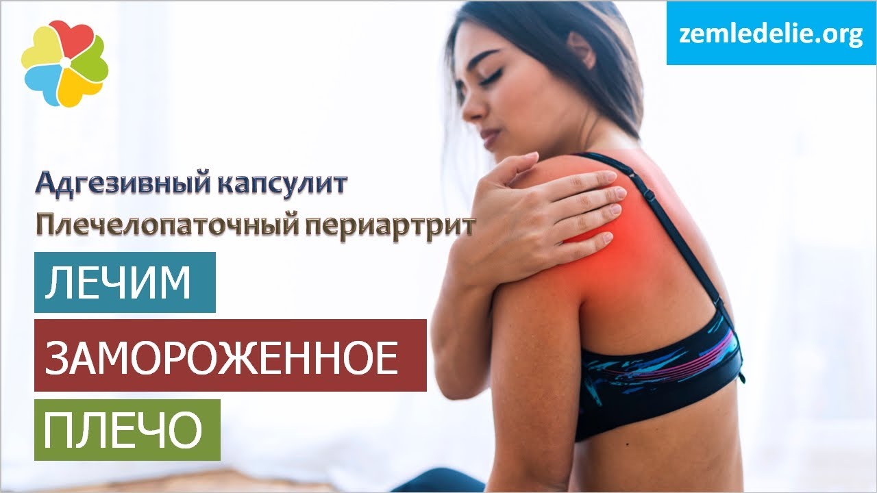 💯Рычаг решает! Адгезивный капсулит | Плечелопаточный периартрит как лечить | Упражнения ЛФК