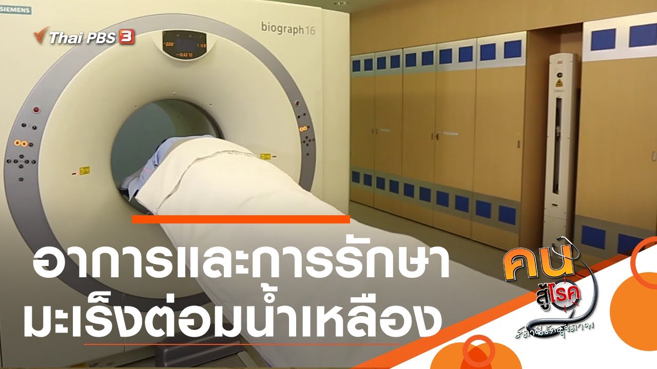 อาการและการรักษามะเร็งต่อมน้ำเหลือง : รู้สู้โรค (15 ก.ย. 63)