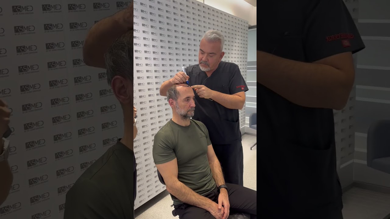 Shots from the hair transplant operation of Semih Saygıner who is the legend of billiard 