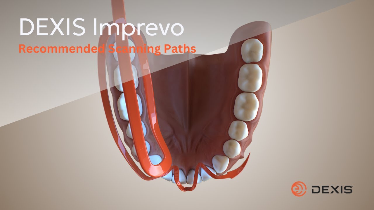 DEXIS Imprevo - Recommended Scanning Paths