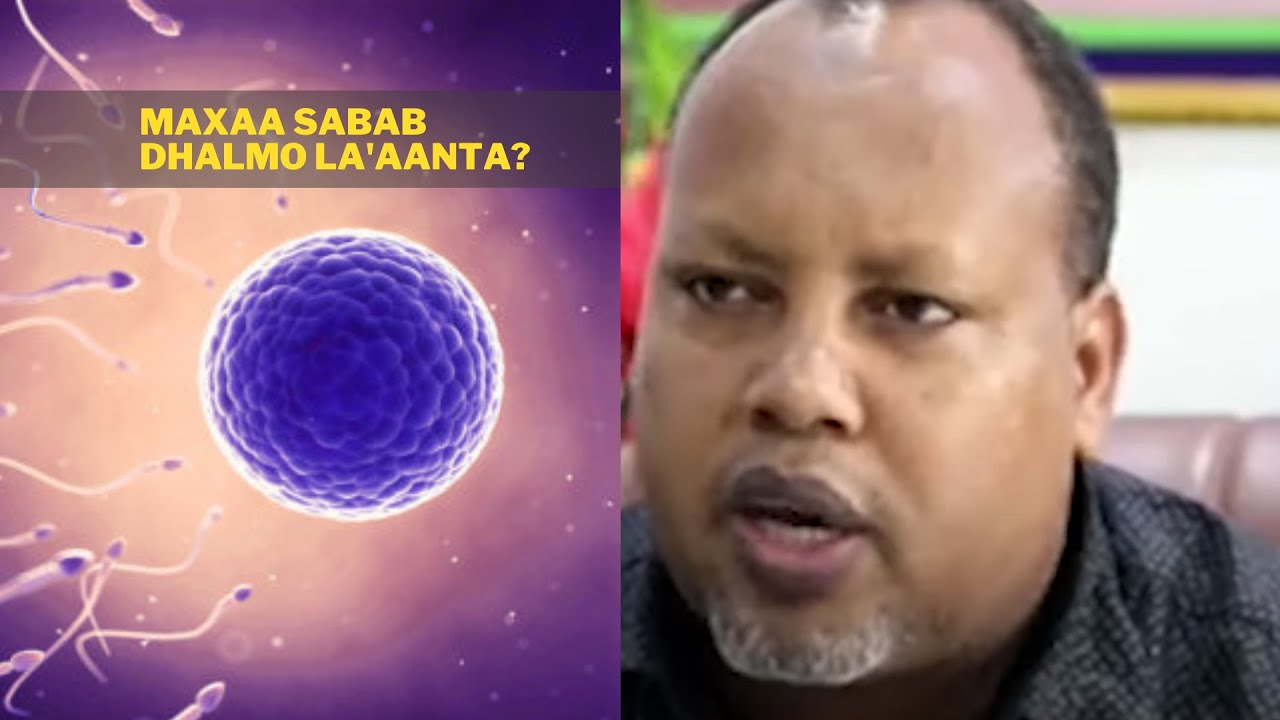 MAXAA SABABA DHALMO LA'AANTA DUMARKA IYO RAGA? | DR ABDIWELI JAMAL AHMED