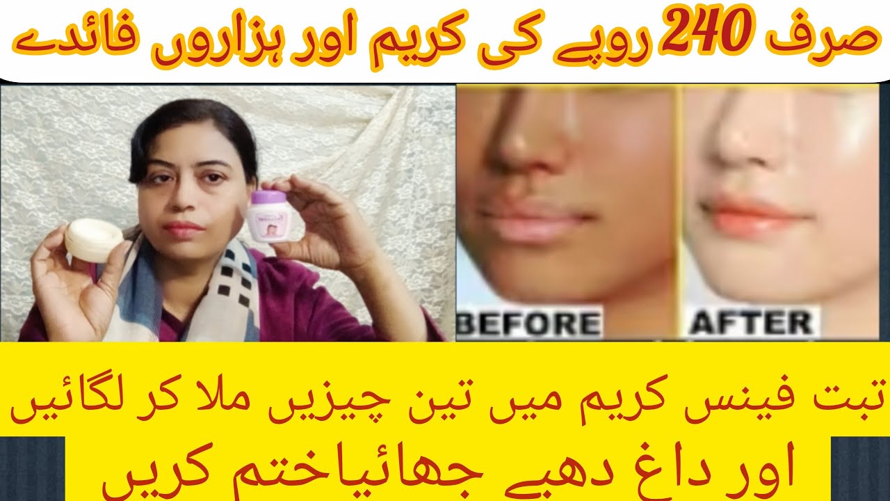 Tibet fairness cream review| use tibeta fairness cream.pigmentation melazma Khatam skin fair kare