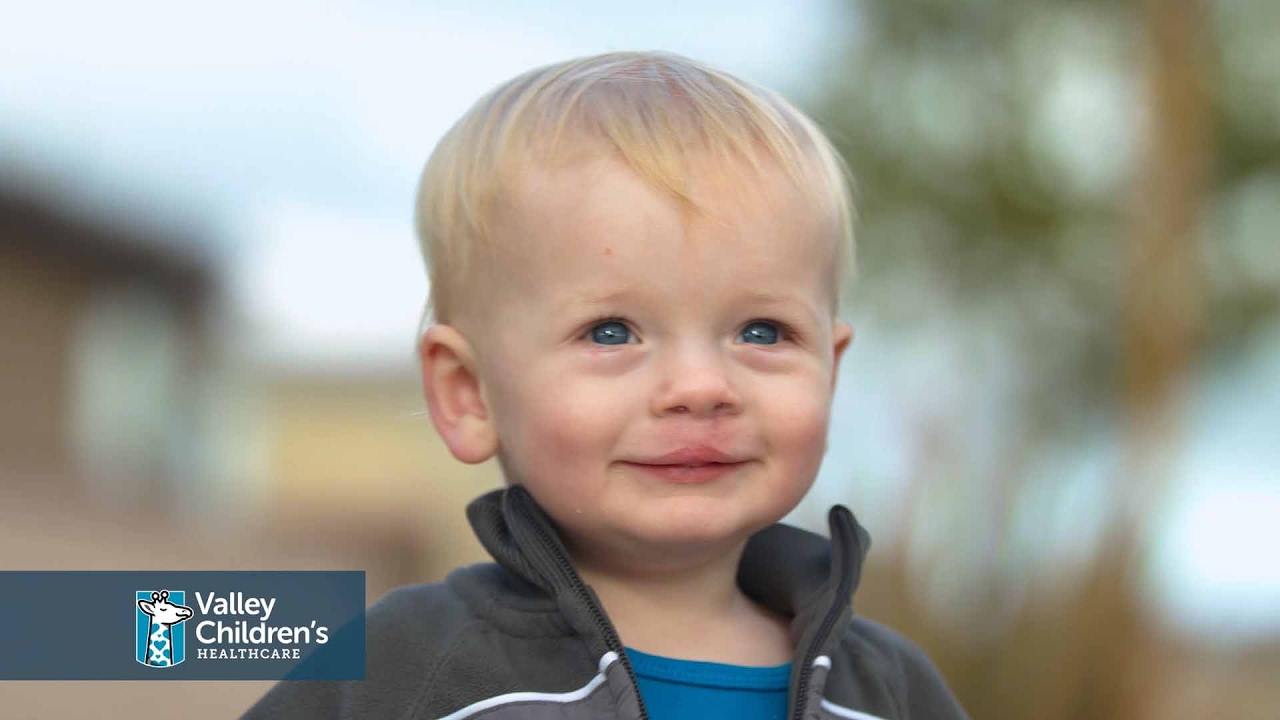 Landon’s Story – Cleft Lip – Plastic Surgery