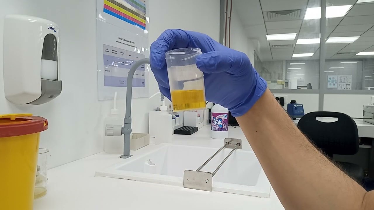 Recherche de toxiques ### Toxicologiques شرح مبسط 🙂🙂🙂technique de laboratoire