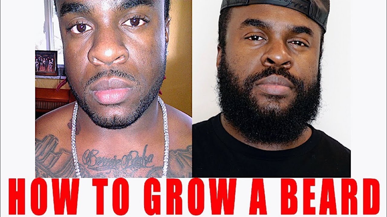 How To Grow A Beard | Does Minoxidil Work For Beard Growth | Minoxidil Beard Transformation