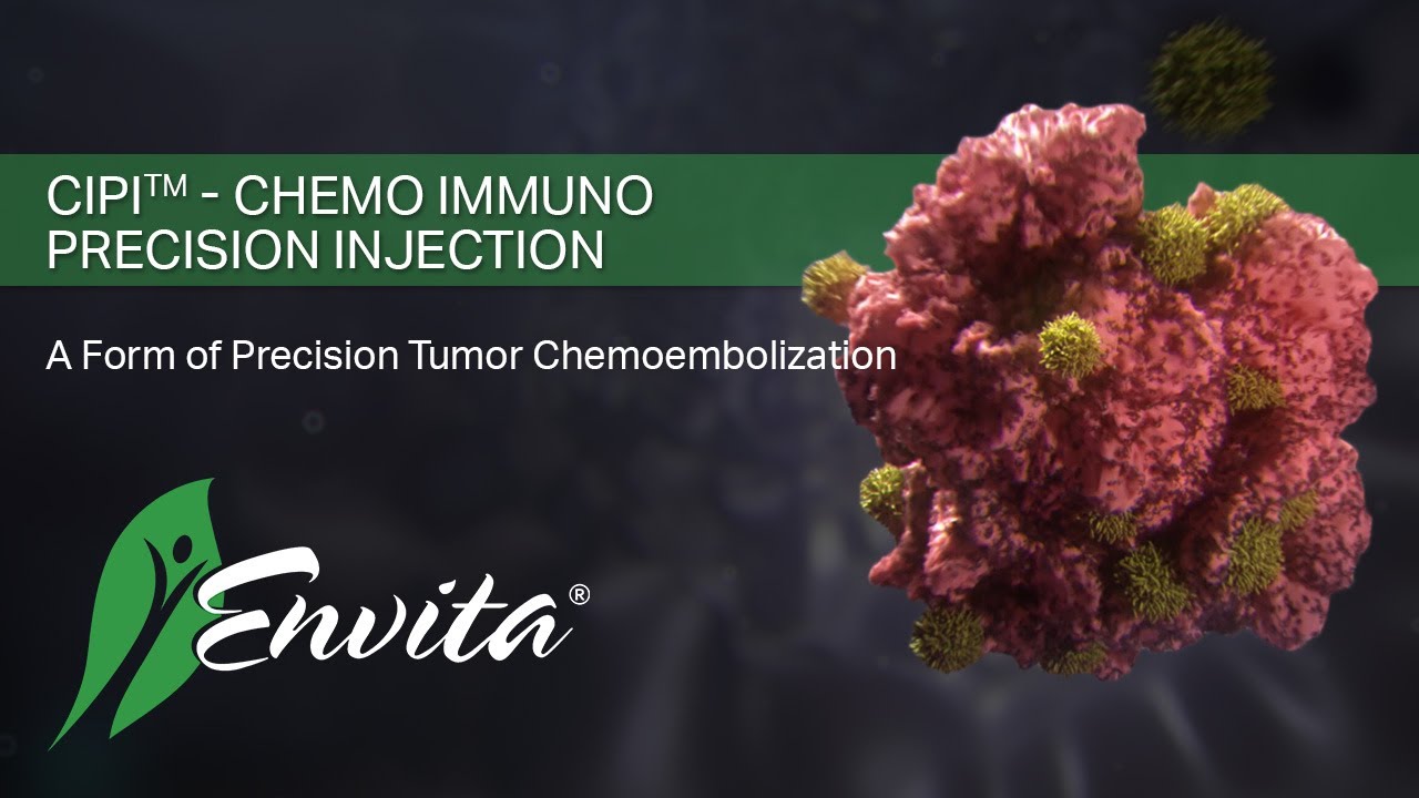CIPI - Chemo Immuno Precision Injection