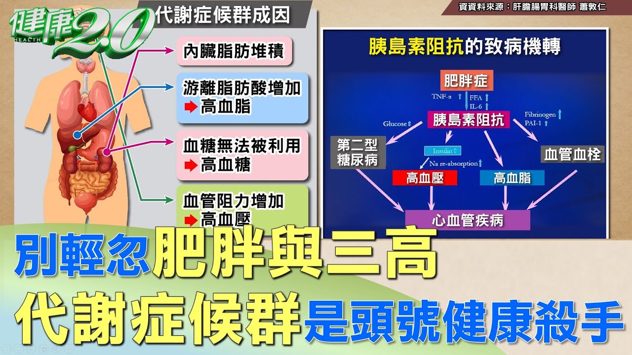 別輕忽肥胖與三高 代謝症候群是頭號健康殺手 健康2.0