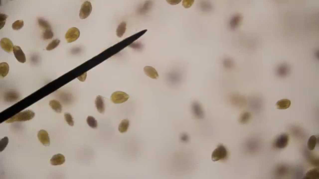 Ostreopsis sp. dinoflagellates exposed to 3% peroxide 100x magnification