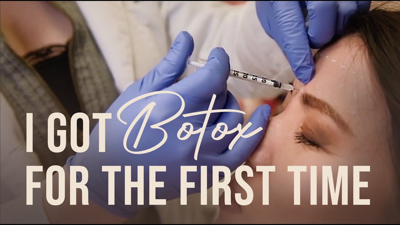 GETTING BOTOX FOR THE FIRST TIME | FOREHEAD, CROW'S FEET, BROW LIFT