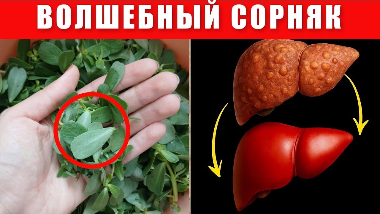 Портулак - сорняк, который спасает от давления, сахара, болезней печени и сердца