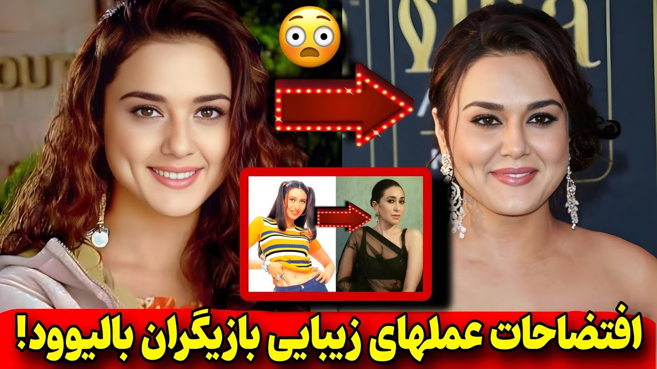 ❌تغییرات عجیب وباورنکردنی بازیگران بالیوود با عملهای زیبایی که بادیدنش میخکوب میشید‼️