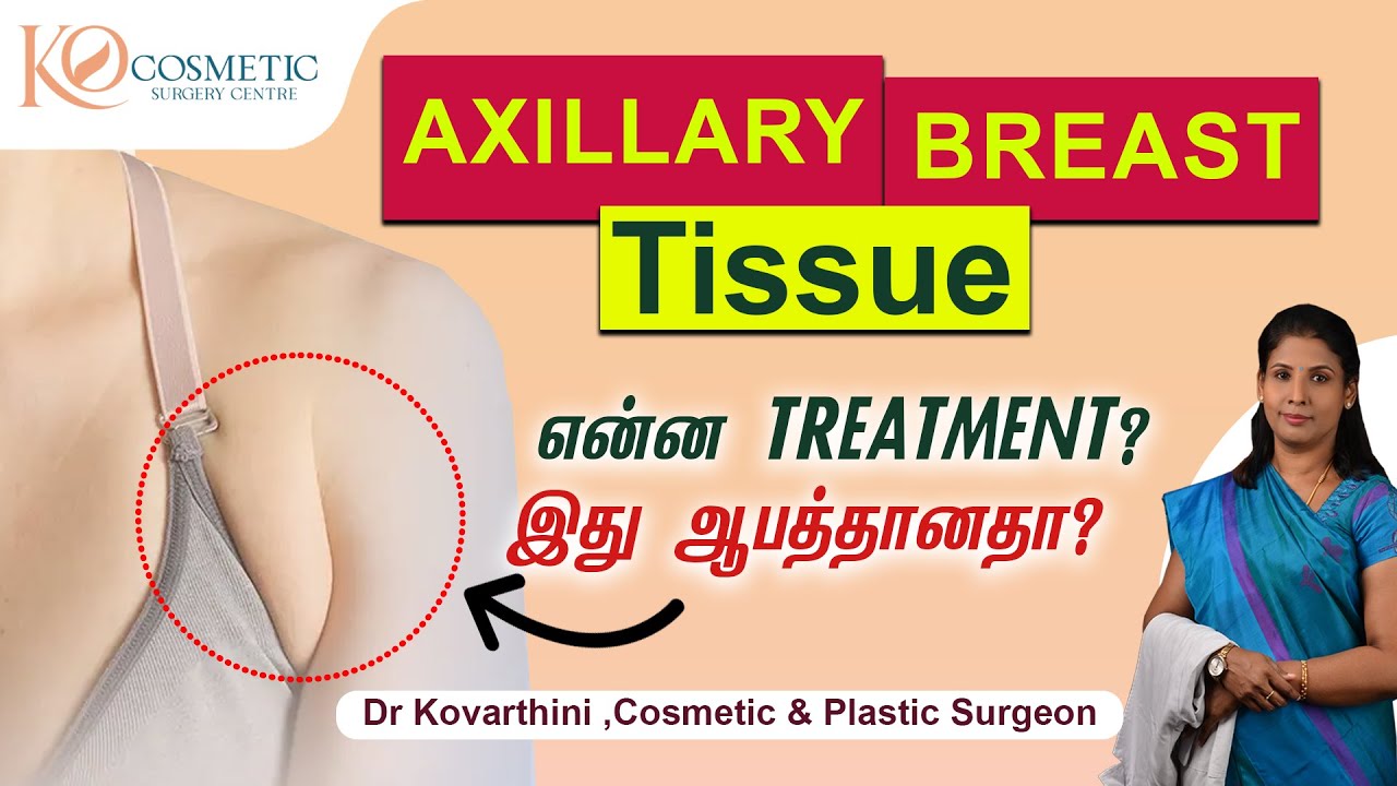 Axillary Breast Removal | Armpit Fat Removal, Causes & Treatment |  Ko Cosmetic Surgery