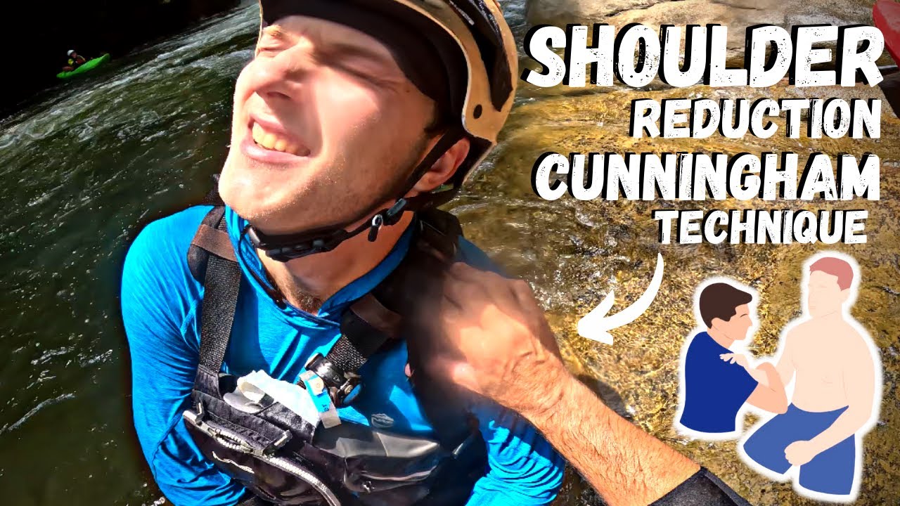 On River Dislocated Shoulder Reduction 