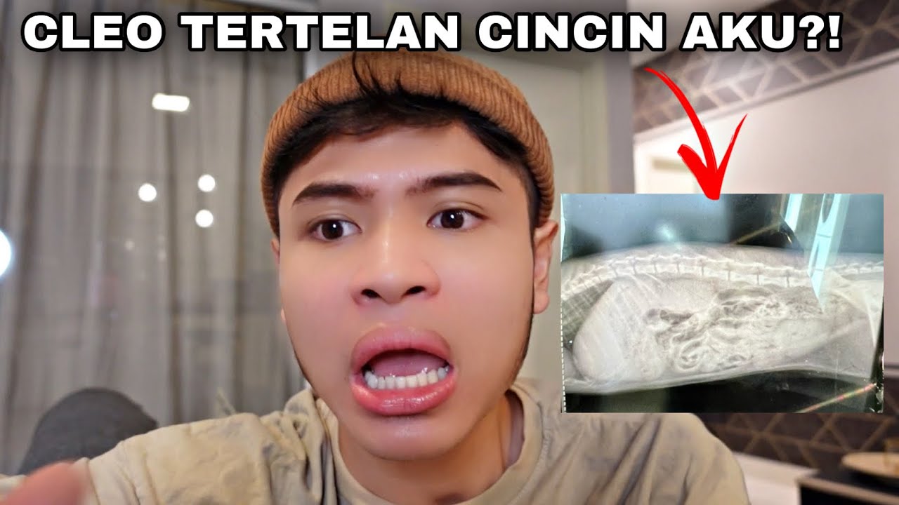 CLEO TERTELAN CINCIN AKU?!😱| KENA PERGI X-RAY MATT‼️