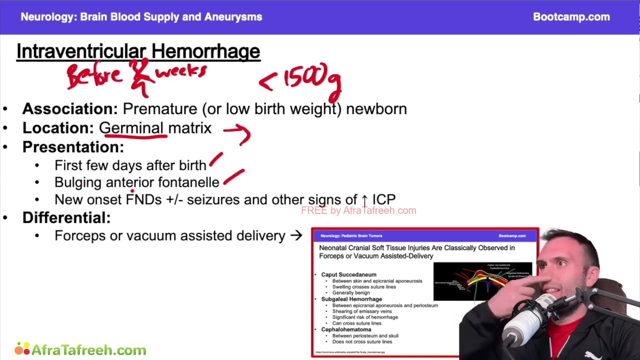 Intraventricular Hemorrhage