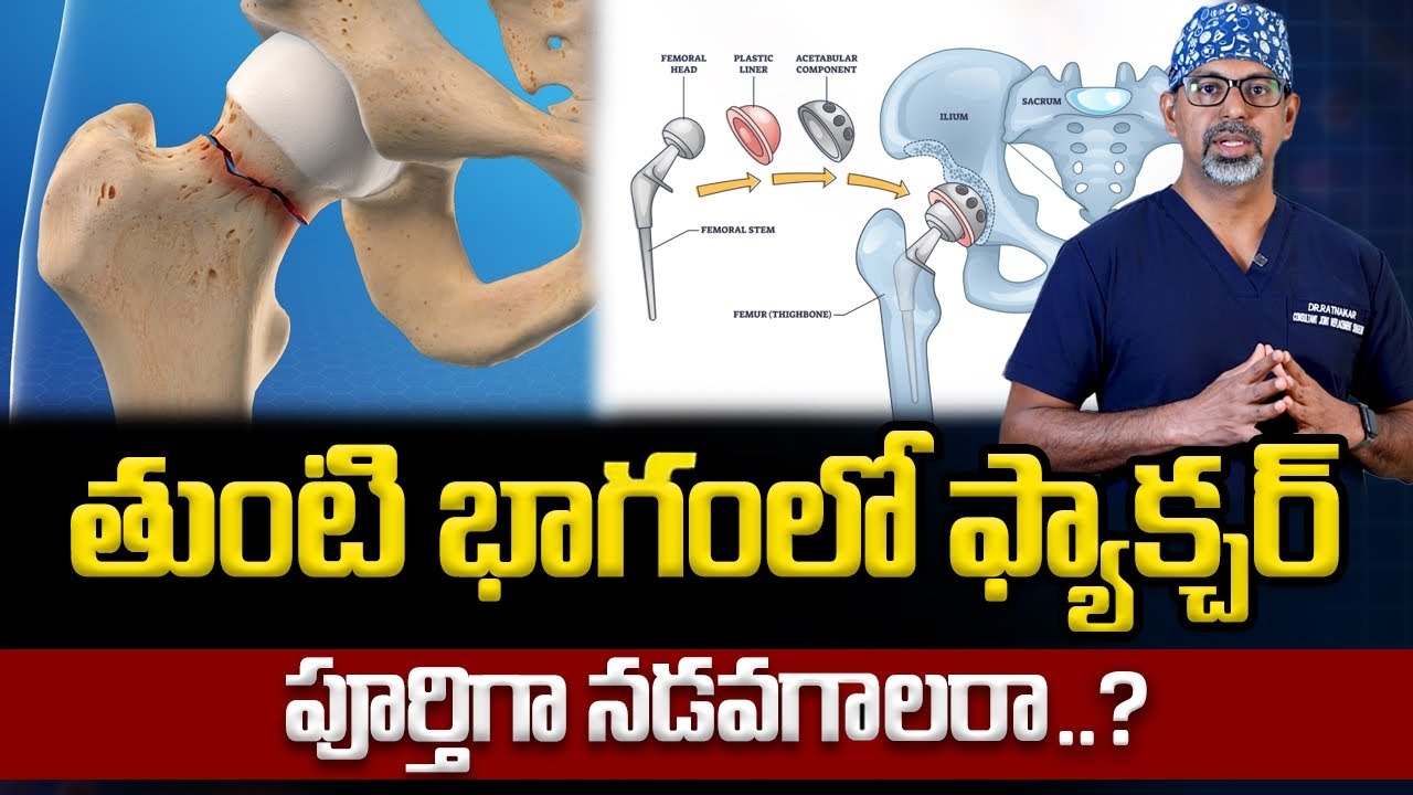 తుంటి ఎముక ఫ్రాక్చర్ – జాగ్రత్తలు | Hip fracture repair | Hip surgery telugu | Hip | Dr Ratnakar Rao