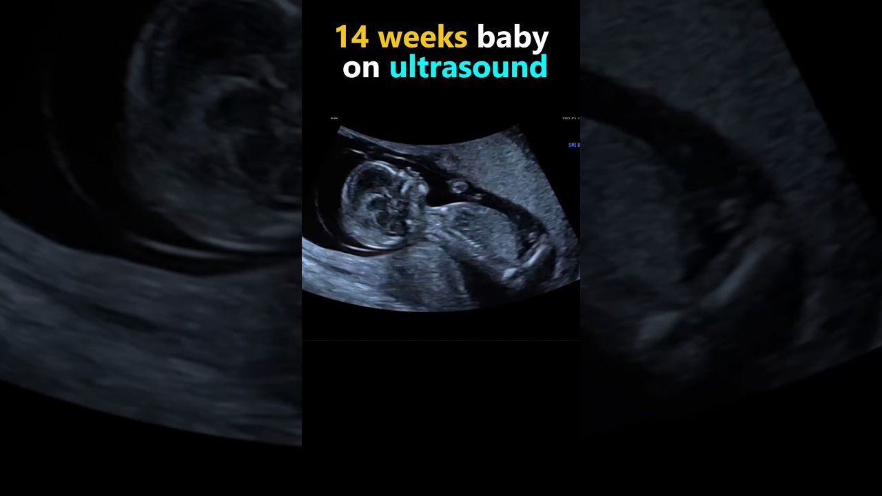 Baby 14 weeks ultrasound 🤰 #pregnancy#baby #babygirl #pregnant