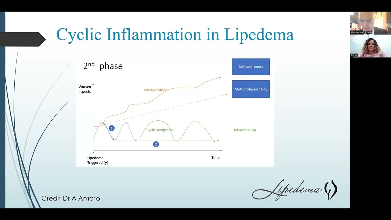 Transforming Lives: Treating Lipedema - A Webinar with Dr. Wright and Lipedema Warrior Trish