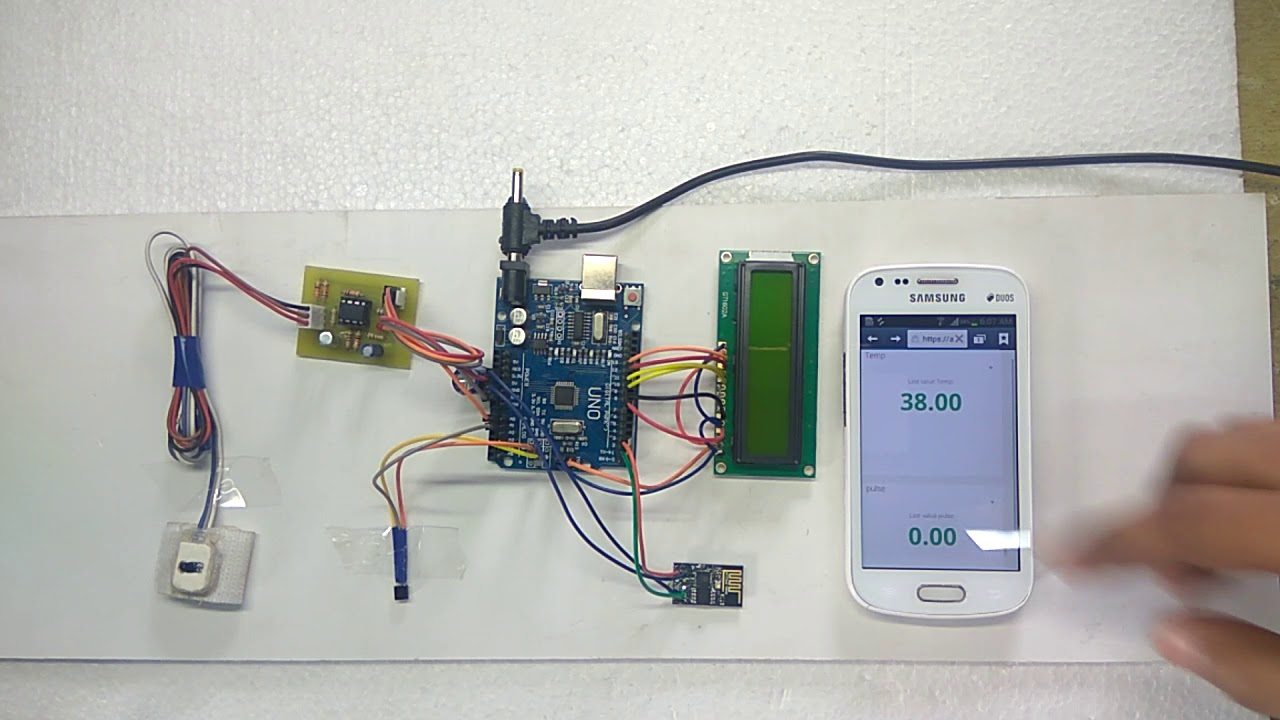 Iot based patient health monitoring system