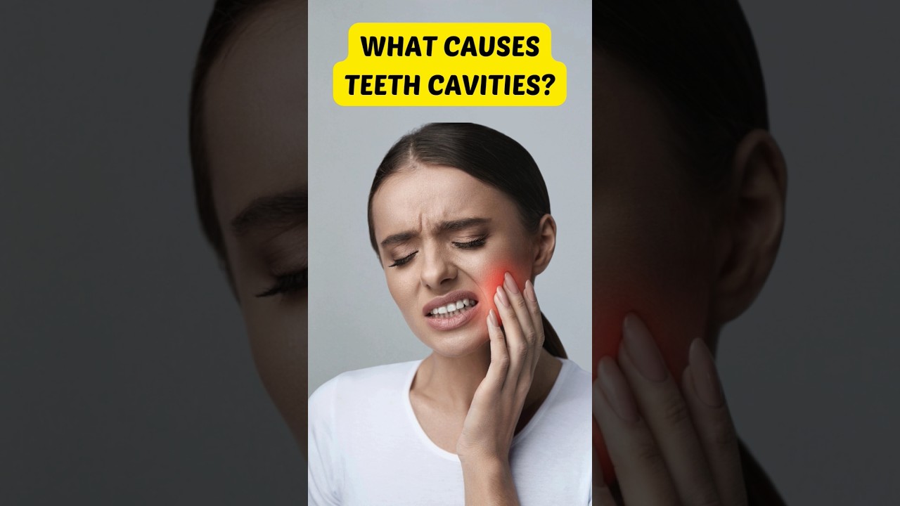 😱 What Causes Teeth Cavities? 