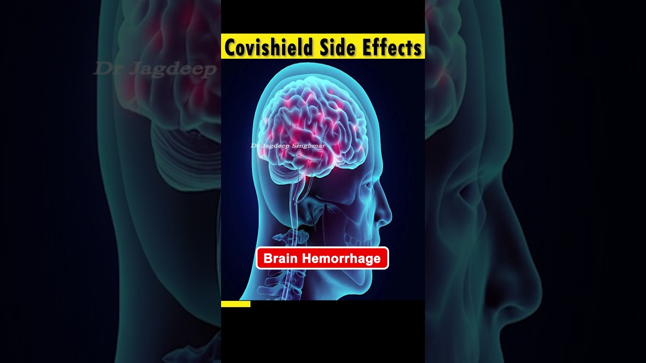 Covishield Side Effects, Can Cause Heart Attack, Brain Hemorrhage | TTS #astrazeneca #covishield