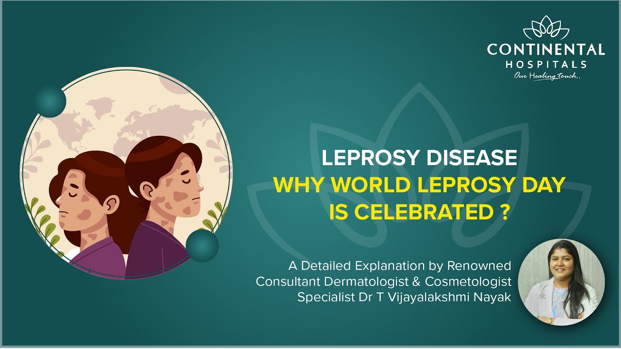 LEPROSY DISEASE Why world leprosy day is celebrated? | Continental Hospitals