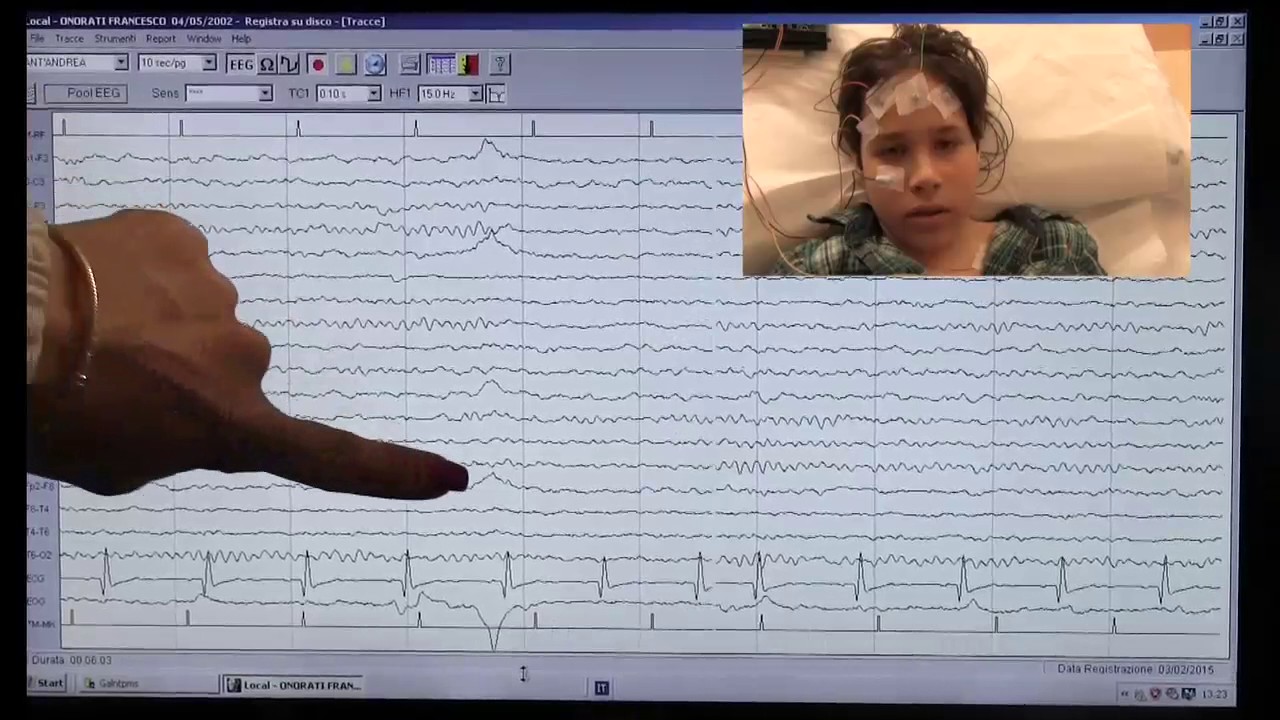 Lettura dati EEG