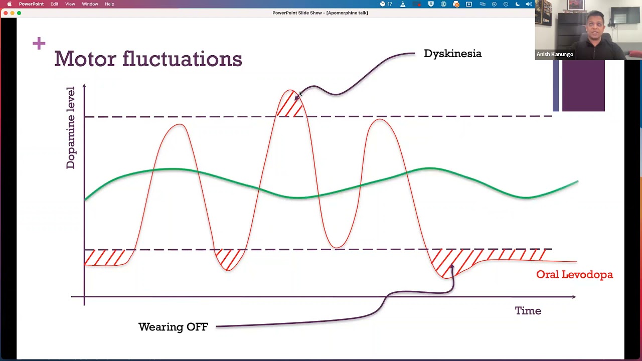 Advanced Therapies Panel Series: Apomorphine