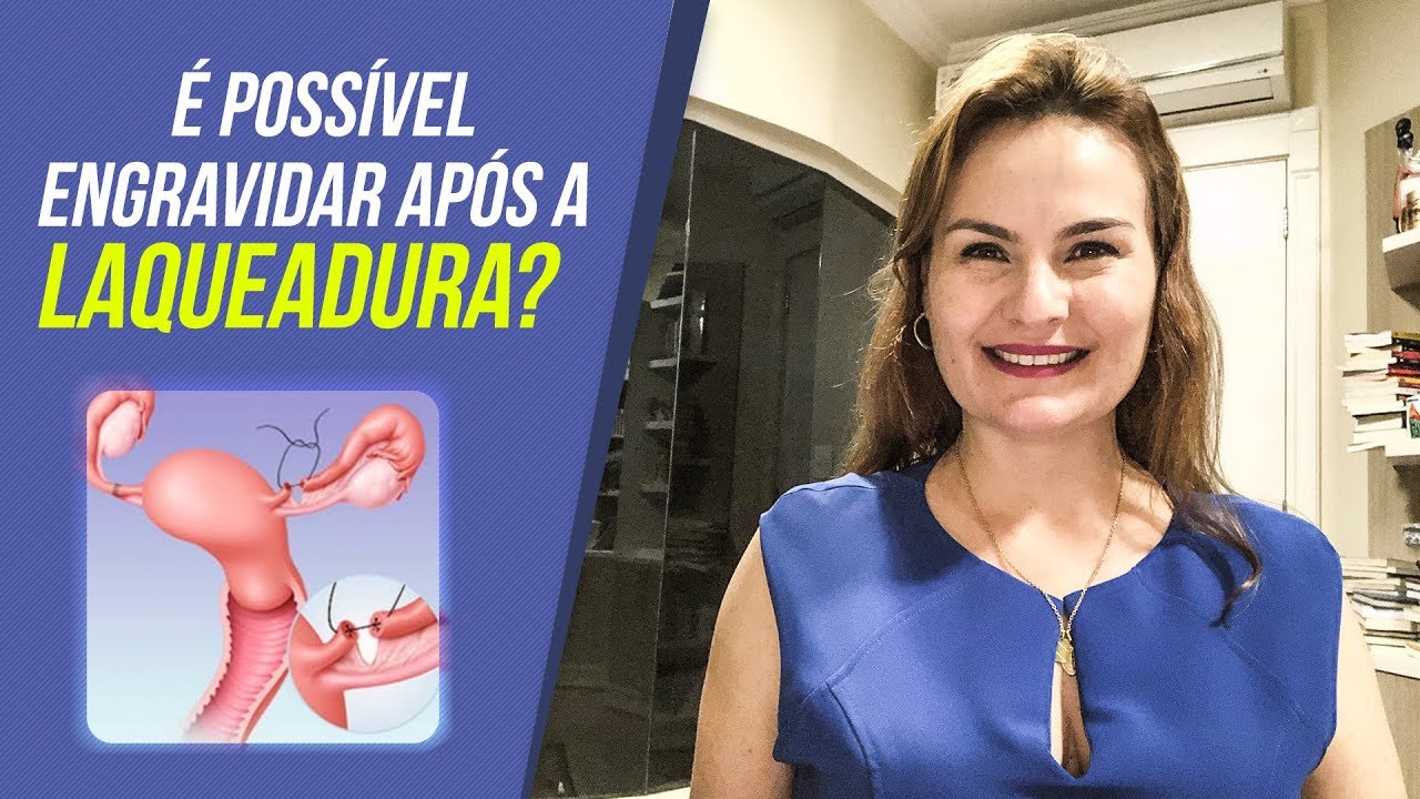 Gravidez após laqueadura. É possível?