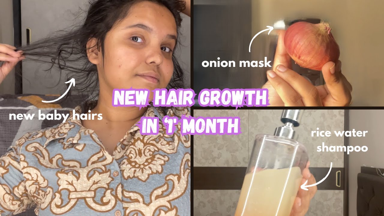 👉 New Hair Growth in 1 Month 🌿 | Onion Hair Mask & Rice Water