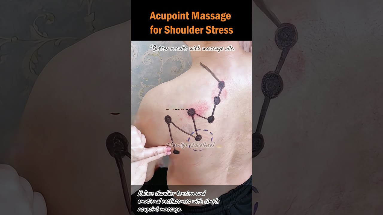 Acupoint Massage for Shoulder Stress