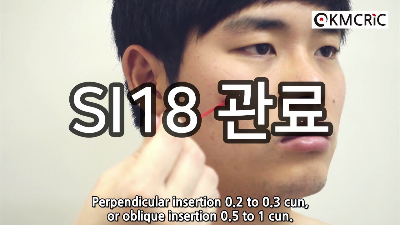 SI18 관료 顴髎 Quanliao (Eng sub) - KMCRIC WHO Standard acupoint DB