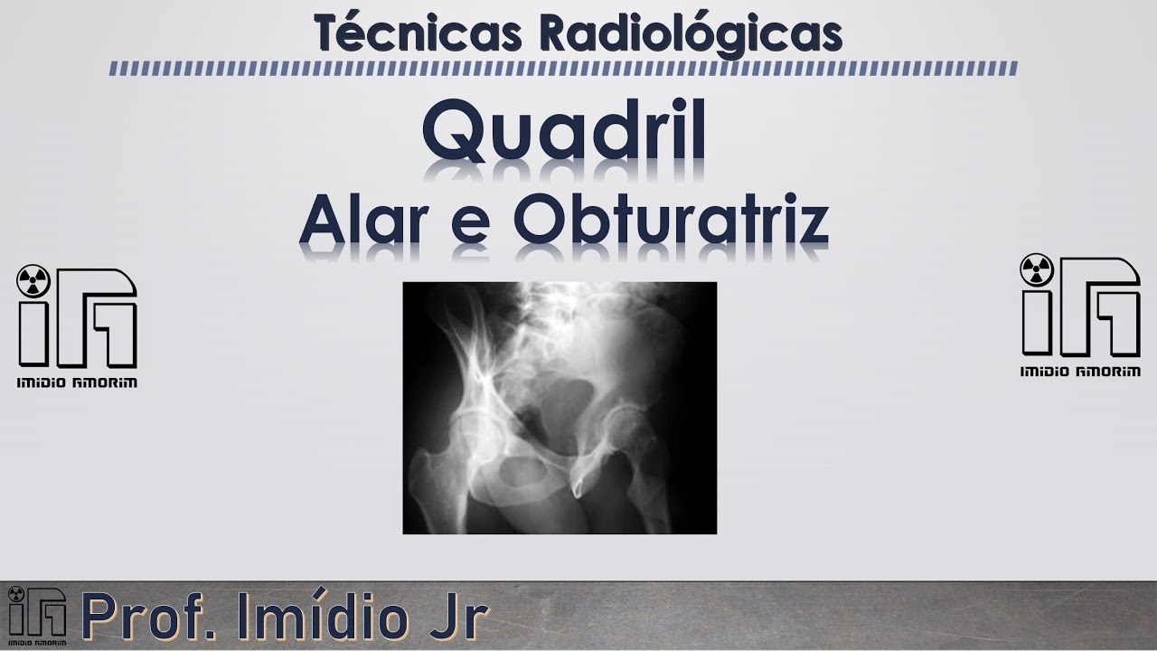 Quadril ou Hemi Pelve - Alar (método de Judet) e Obturatriz