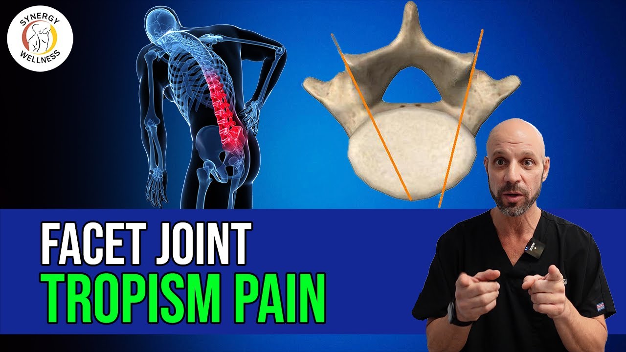 Facet Joint Tropism Pain