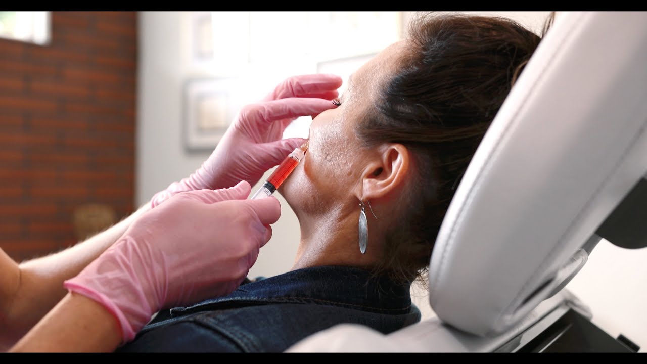 Platelet Rich Fibrin (PRF) and Platelet-Rich Plasma (PRP) Injections / Renew Aesthetics