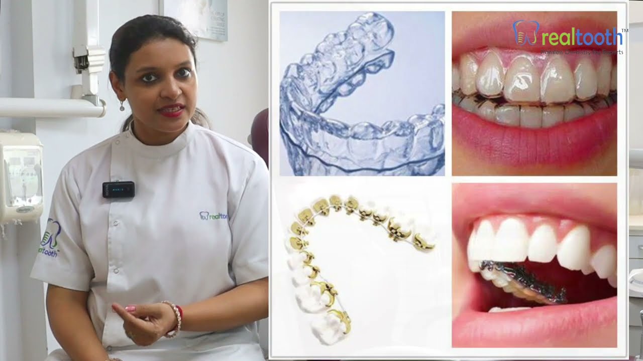 Secrets of Straight Teeth - The Quest to Align Without Braces!