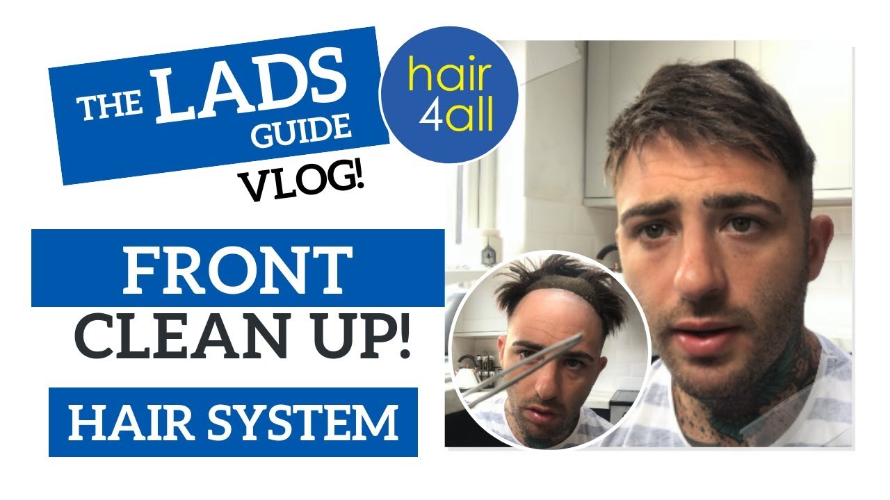 Front Clean Up | Hair System | Non-Surgical Hair Replacement System for Men/Women