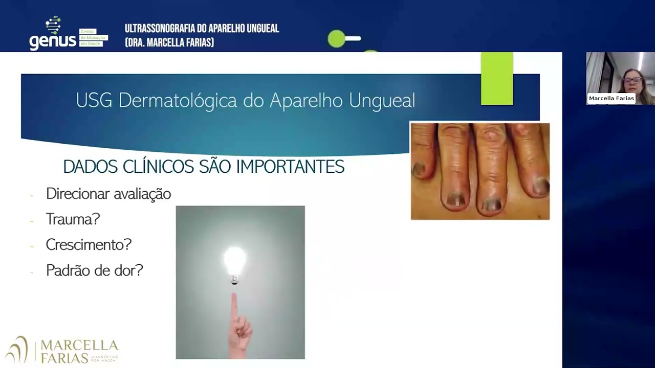 Webinar: Ultrassonografia do Aparelho Ungueal