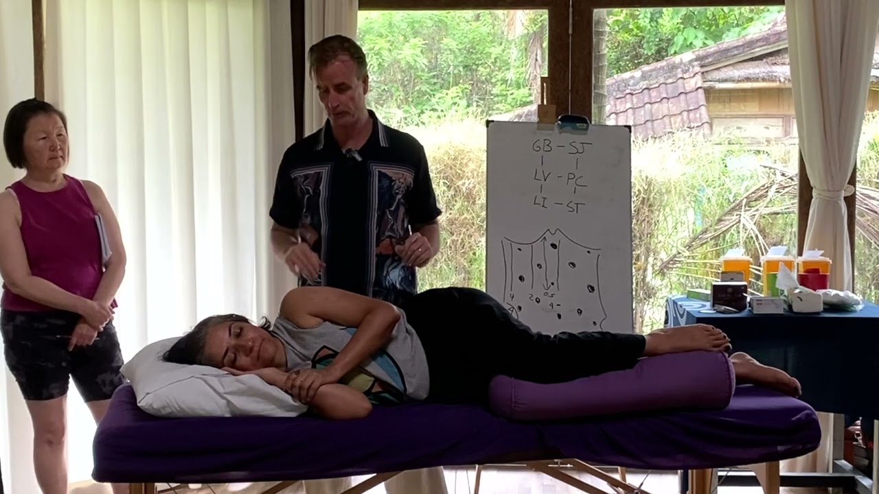 Acupuncture in Lateral Position & Master Tung's Points 33.08, 33.09, 22.07 & Yao Tong Xue