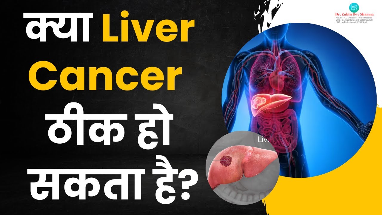 क्या Liver Cancer को ठीक कर सकते है? || Liver Cancer Symptoms, Causes, Treatment #livercancer