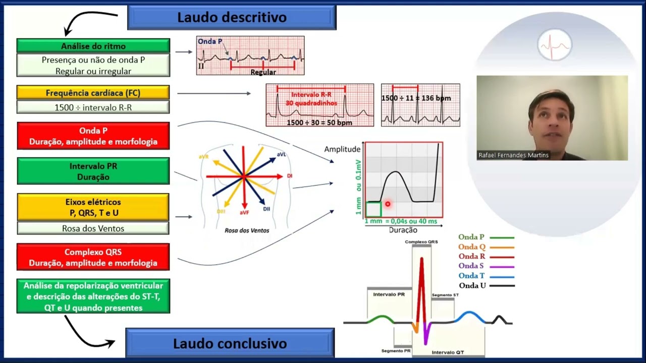 Como laudar um eletrocardiograma parte 2/4 (praticando)