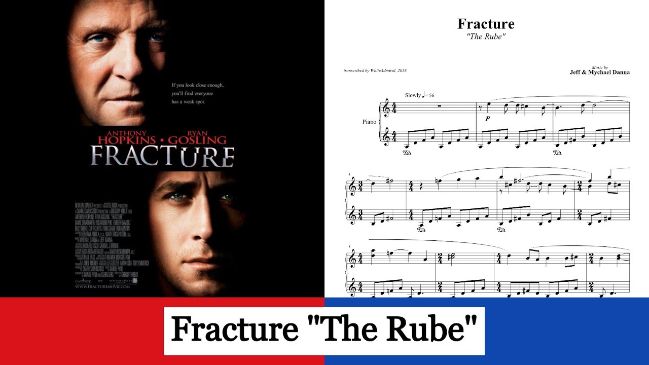 Fracture 