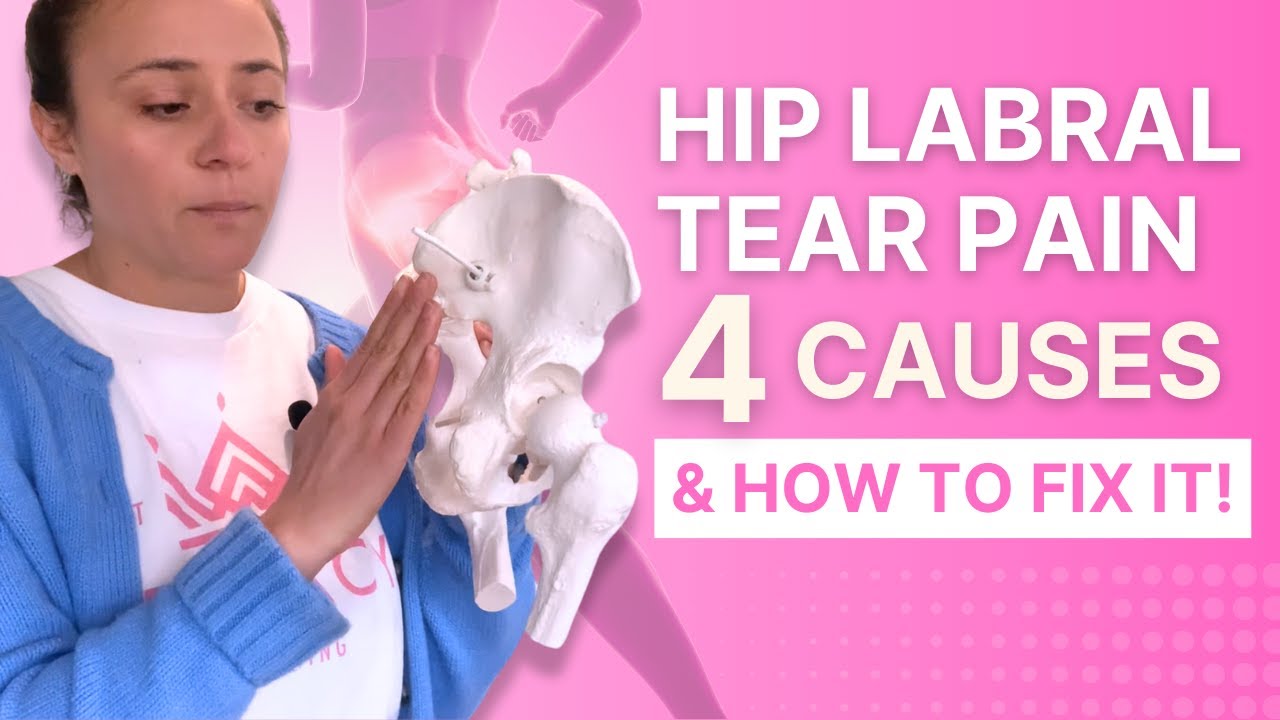 🏃‍♀️ Hip Labral Tear Pain: 4 Reasons It Hurts & How to Get Relief