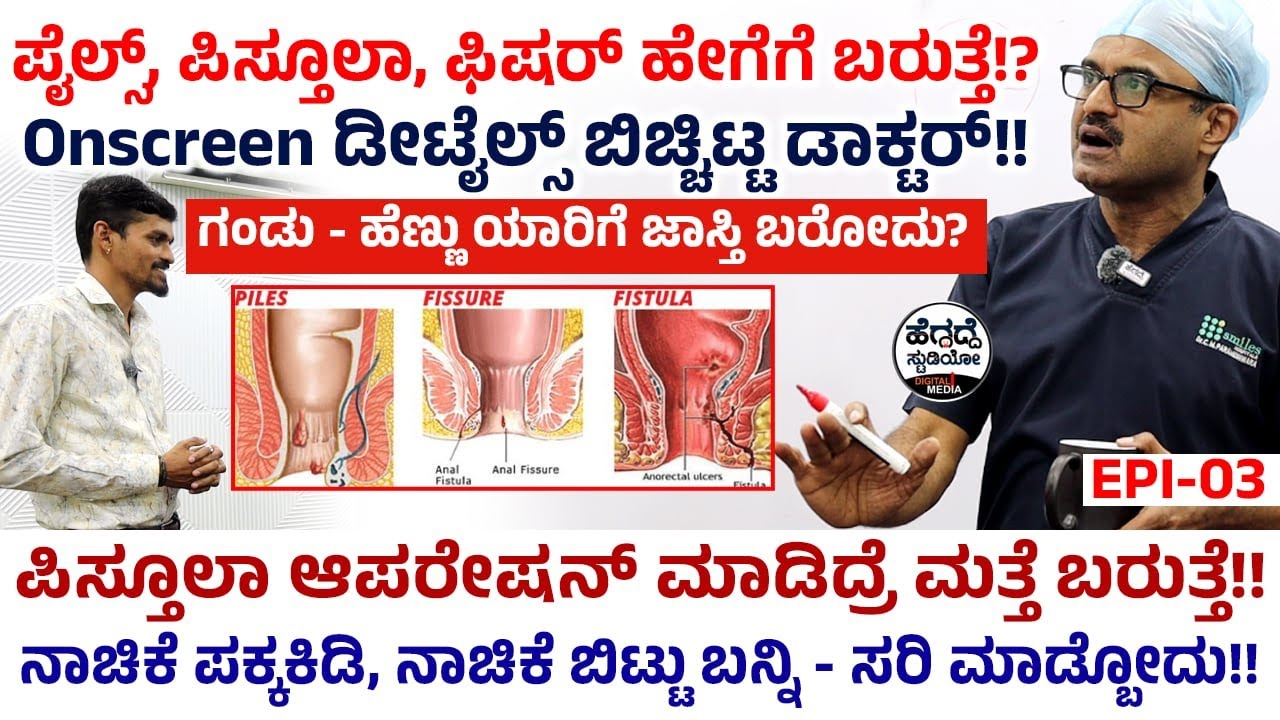 'ಪೈಲ್ಸ್, ಪಿಸ್ತೂಲಾ, ಫಿಷರ್' ಹೇಗೆಗೆ ಬರುತ್ತೆ!?  ಯಾರಿಗೆ ಜಾಸ್ತಿ ಬರೋದು? Onscreen ಡೀಟೈಲ್ಸ್ ಬಿಚ್ಚಿಟ್ಟ ಡಾಕ್ಟರ್