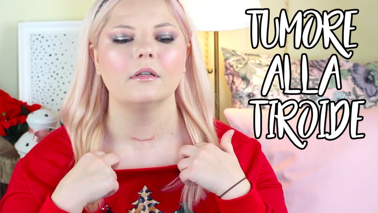 Tumore alla Tiroide la mia Esperienza | Storytime ita