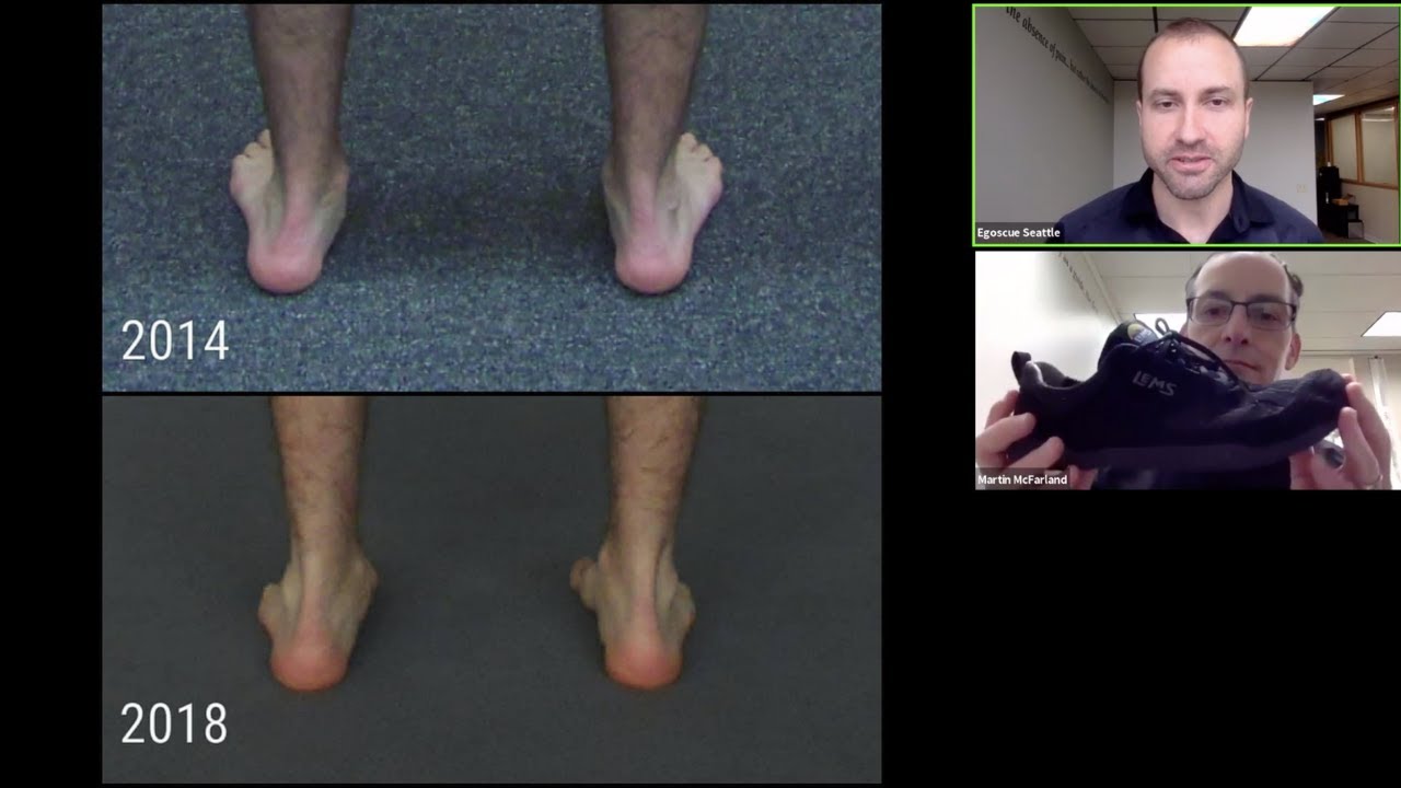 The Egoscue Method // Orthotics - TMJ  - 